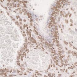 RPA2, p Ser4, p Ser8 Antibody, Novus Biologicals 0.1mL; Unlabeled:Antibodies,